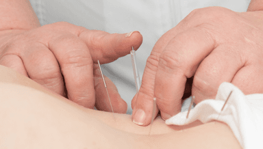 Image for Acupuncture 
