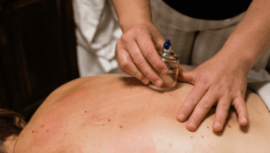 Image for 30min Massage with Cupping