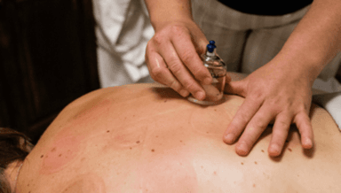 Image for 60min Massage with Cupping